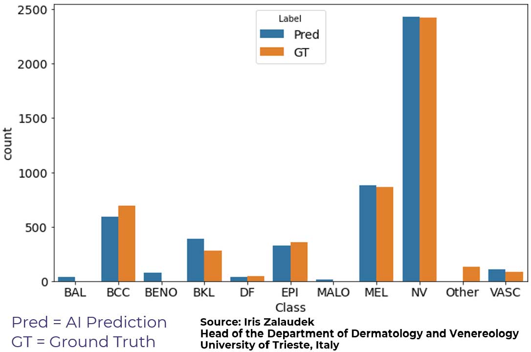 Dermoscopy Trial Image 1